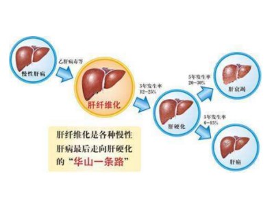 全自动生化分析仪厂家可检测肝功的这些项目—山东国康