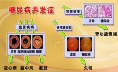 国产生化分析仪提醒预防肾病糖尿病，一定要定期检查-山东国康