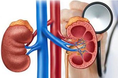 全自动生化分析仪厂家-怎样预防肾炎复发 -山东国康