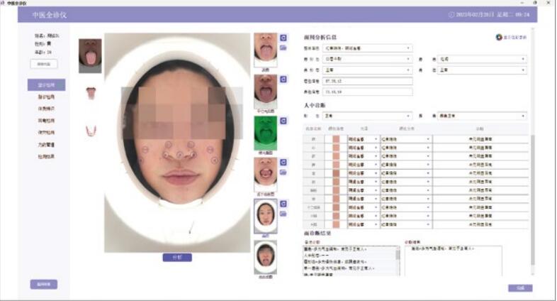 （中医全诊仪）舌面脉经穴信息采集管理系统（二代）面诊采集界面.jpg